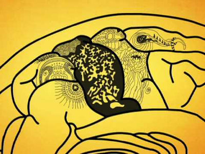 Alzheimer's Disease in 3 Minutes